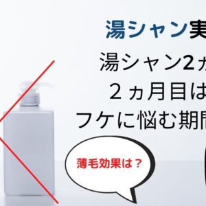 【まだ間に合う】若ハゲが治らない！これ以上進行させる前にやるべきおすすめ方法3選